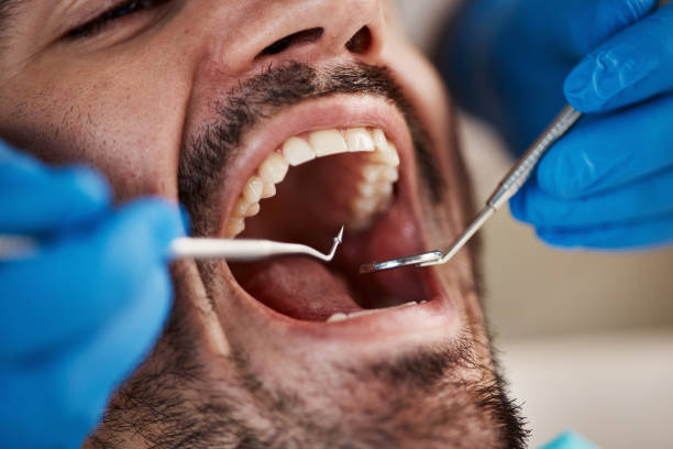 Best Emergency Denture Repair in Stickney, IL